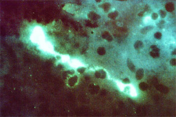 Chlamydophila-psittaci--Erreger-der-Ornithose